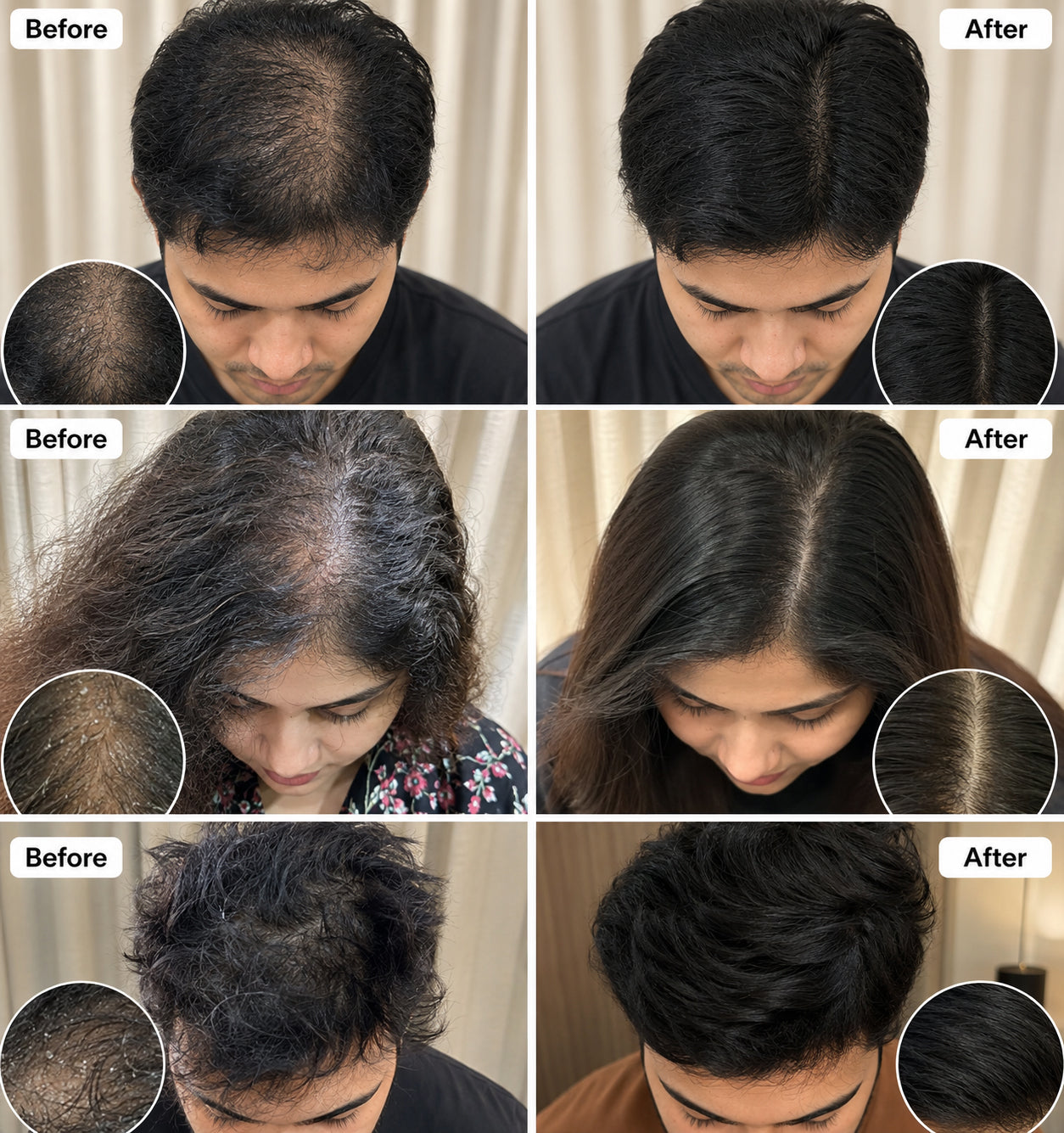 Before and after hair treatment comparisons on individuals with different hair conditions - Effects of Wonder Hair Oil By Azomorfia